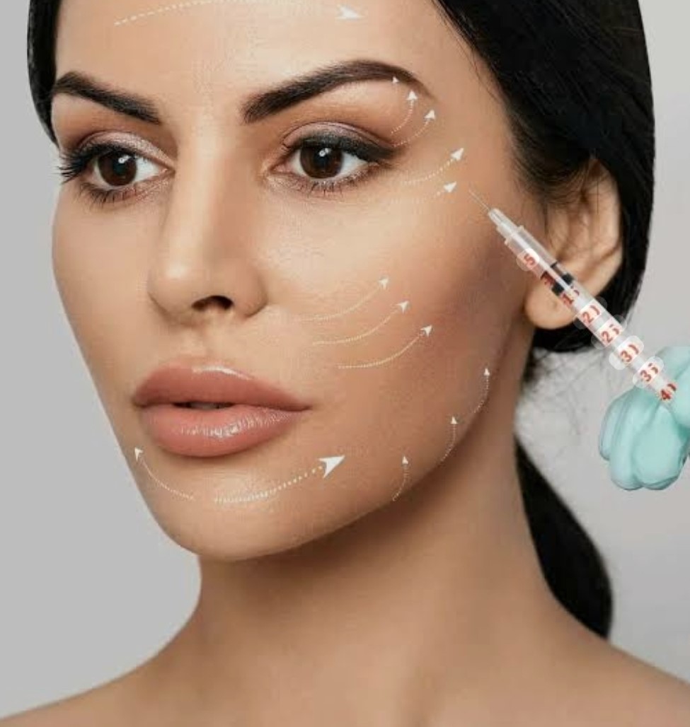 Tratamiento de rellenos faciales con Ácido Hialurónico y Sculptra