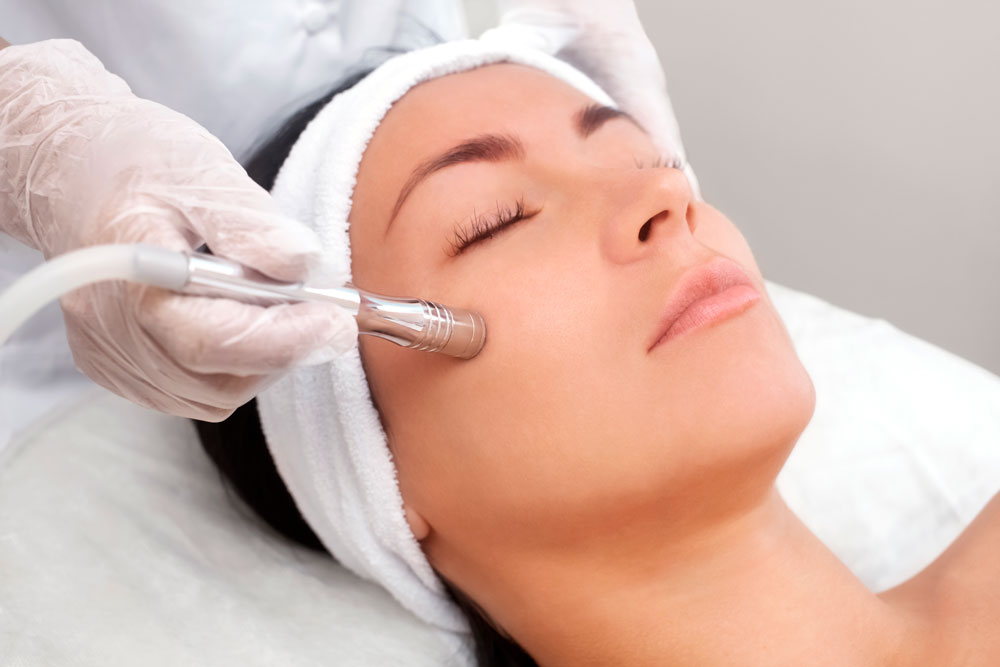 Exfoliación mecánica con puntas de diamante - Microdermoabrasión