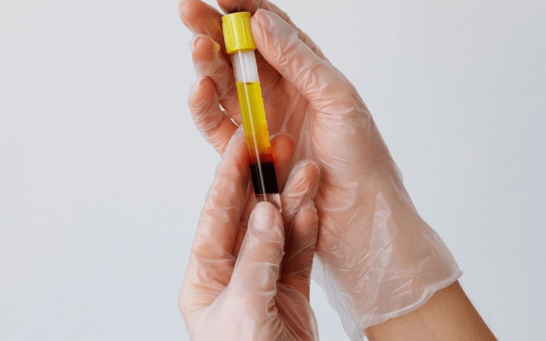 Tratamiento de Dermapen con Plasma Rico en Plaquetas (PRP) en Panamá